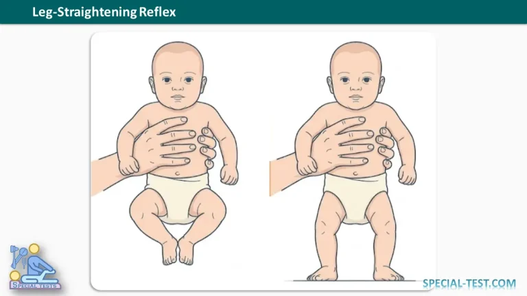 Leg Straightening Reflex