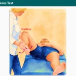 Ligamentum Teres Test
