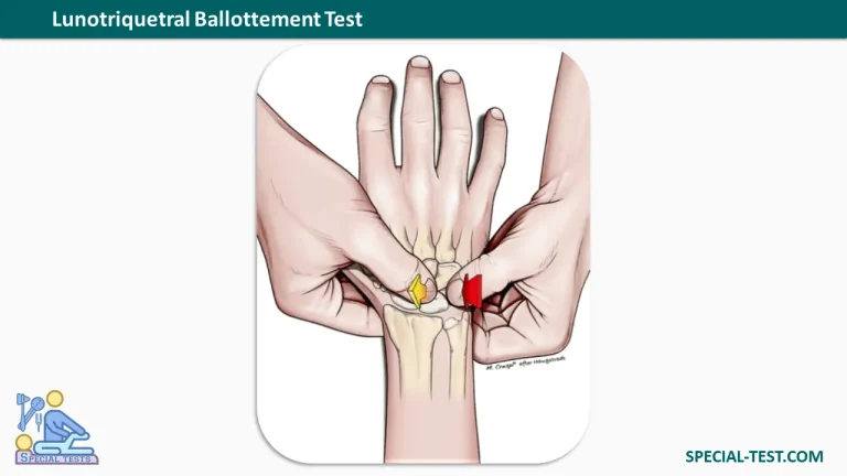 Lunotriquetral Ballottement Test