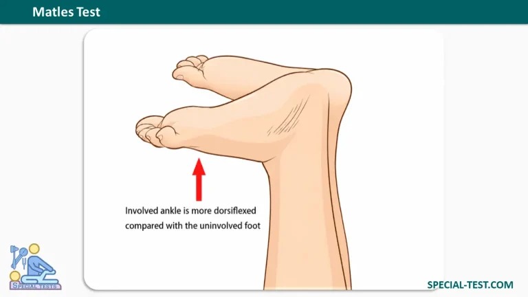 Matles Test