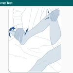 Medial McMurray Test