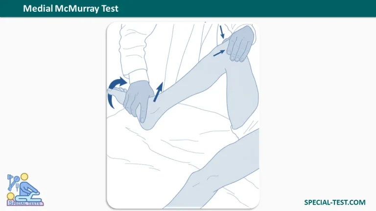Medial McMurray Test