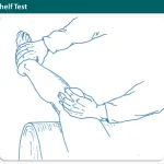 Medial Plica Shelf Test