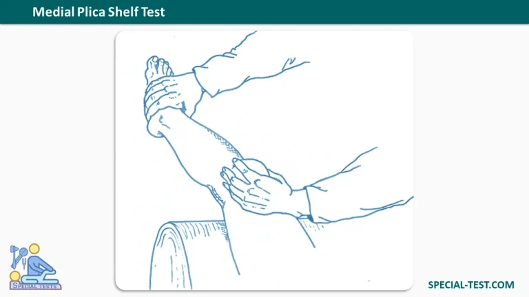 Medial Plica Shelf Test