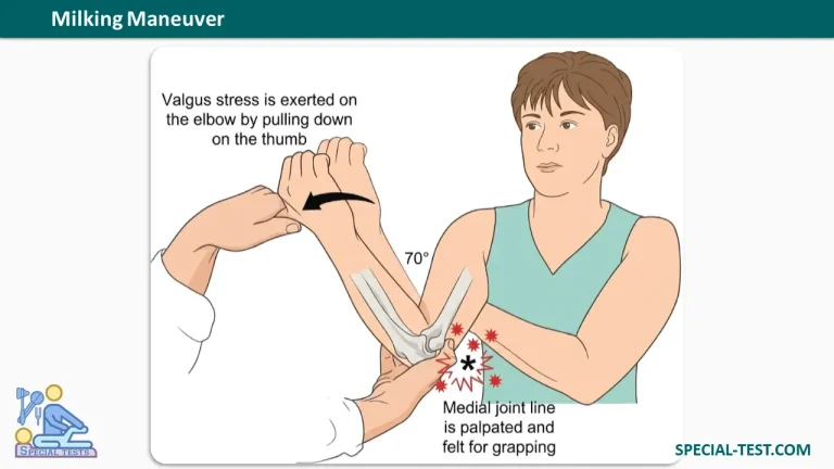 Milking Maneuver