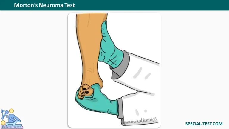 Mortons Neuroma Test