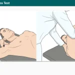 Norwood Stress Test