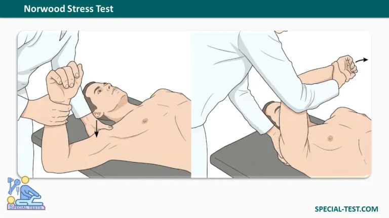 Norwood Stress Test