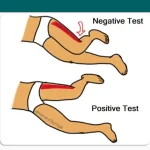Obers Test