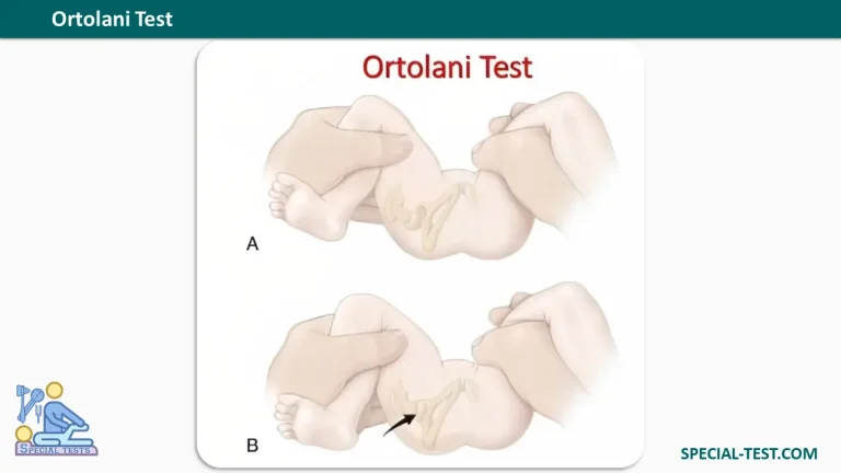 Ortolani Test