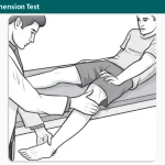 Patella Apprehension Test
