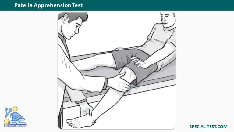 Patella Apprehension Test