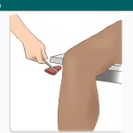 Patellar reflex