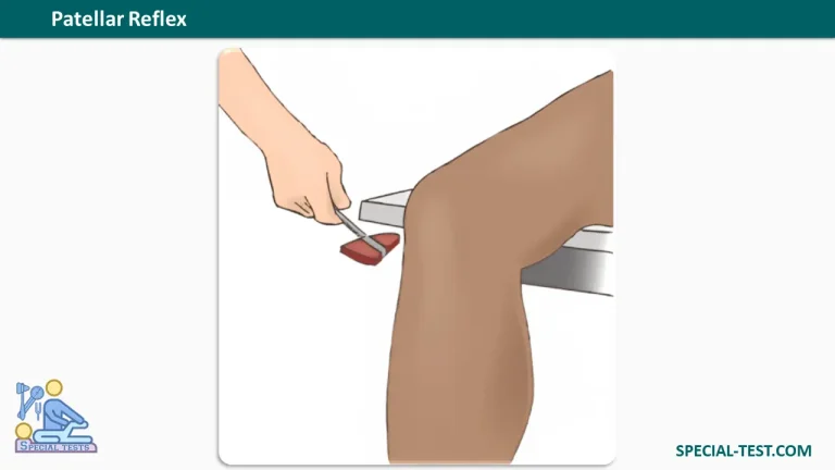 Patellar reflex