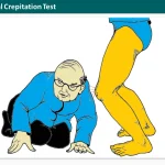 Patellofemoral Crepitation Test