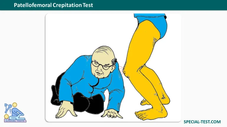 Patellofemoral Crepitation Test