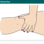 Patellofemoral Grind Test