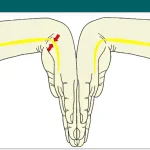 Phalen’s Test