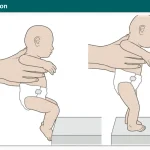 Placing Reaction