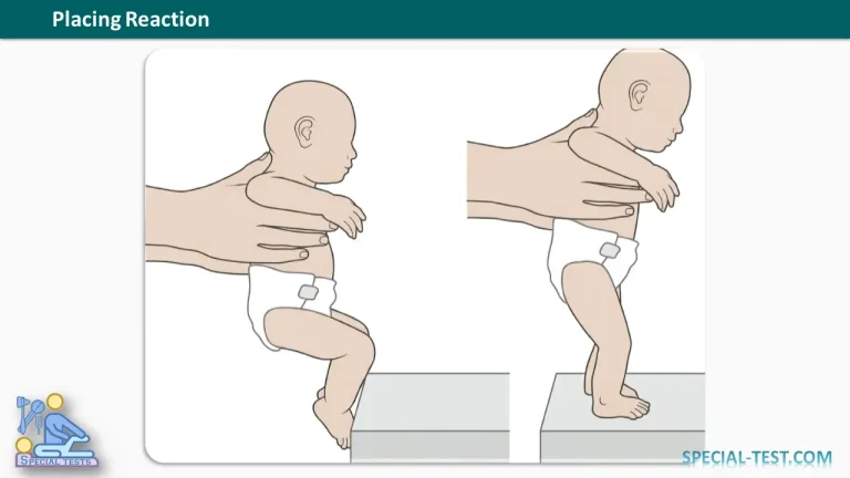 Placing Reaction