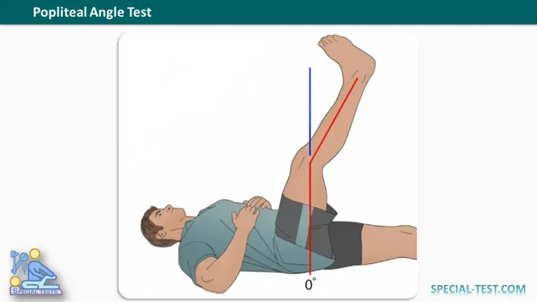 Popliteal Angle Test