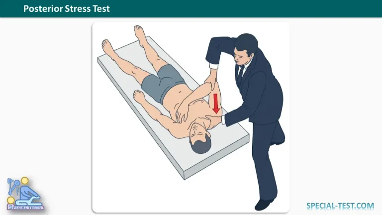 Posterior Stress Test