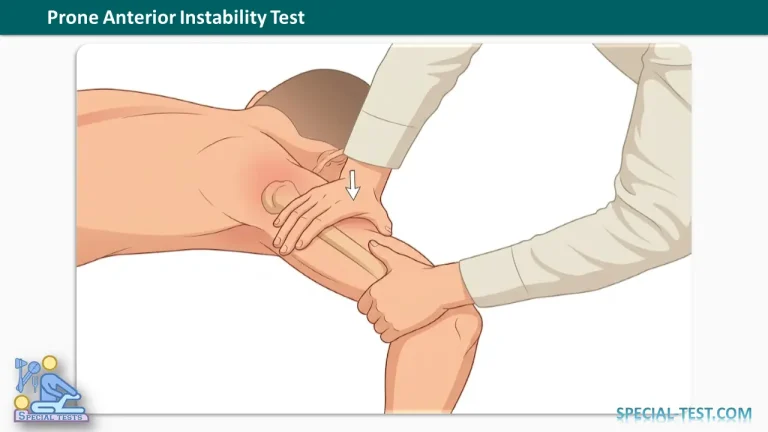 Prone Anterior Instability Test
