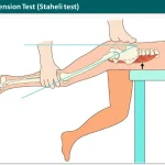 Prone Hip Extension Test Staheli test