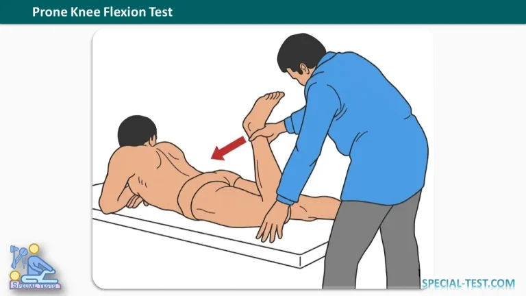 Prone Knee Flexion Test