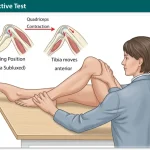 Quadriceps Active Test