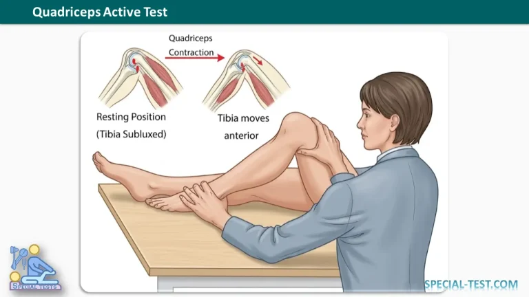 Quadriceps Active Test