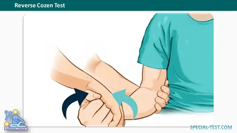Reverse Cozen Test