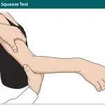 Ruland Biceps Squeeze Test