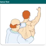 Scapular Assistance Test