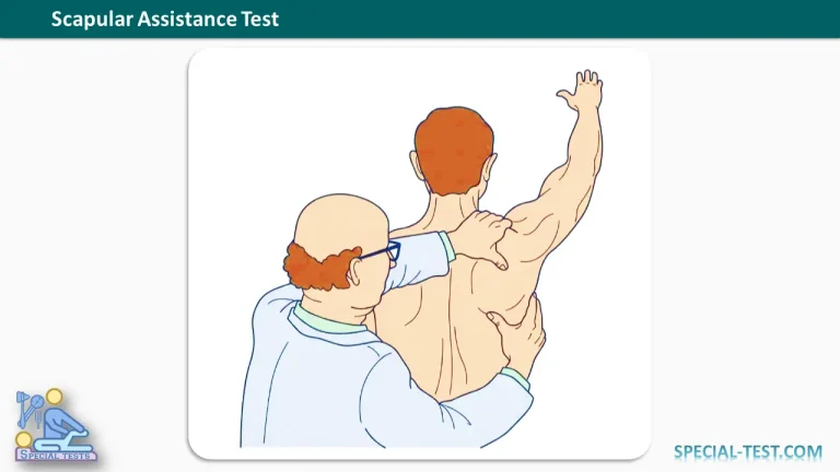 Scapular Assistance Test