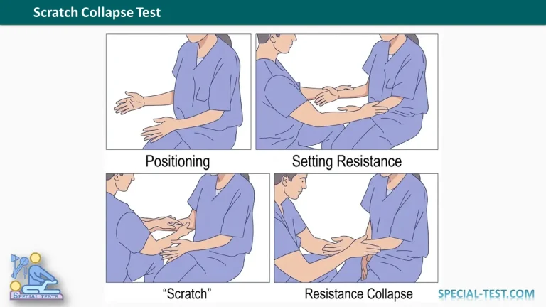 Scratch Collapse Test