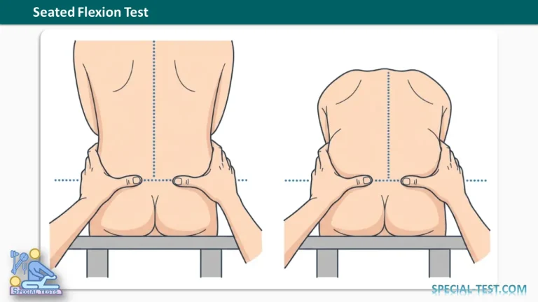 Seated Flexion Test