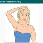 Shoulder Abduction Test (Bakody Test)