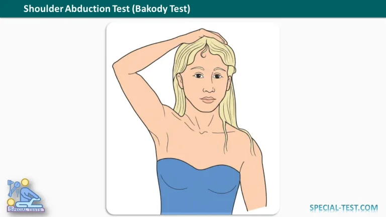 Shoulder Abduction Test Bakody Test
