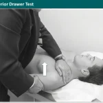 Shoulder Anterior Drawer Test