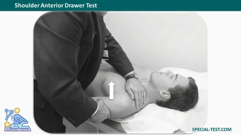 Shoulder Anterior Drawer Test