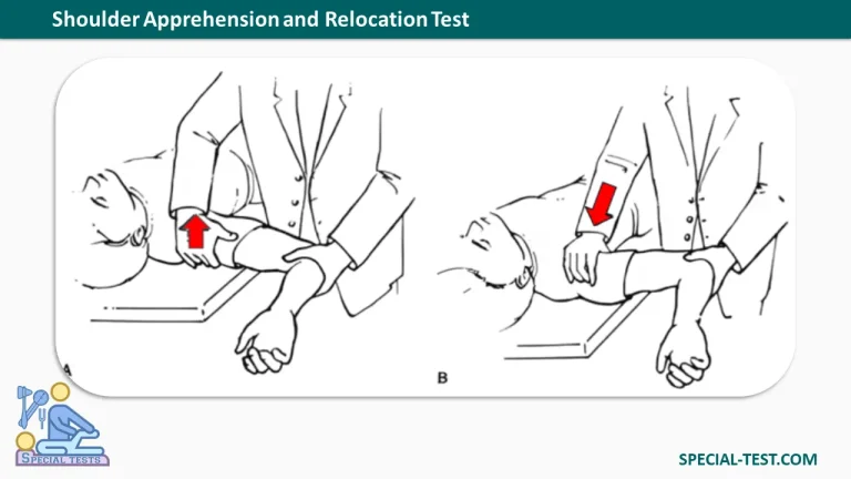 Shoulder Apprehension and Relocation Test