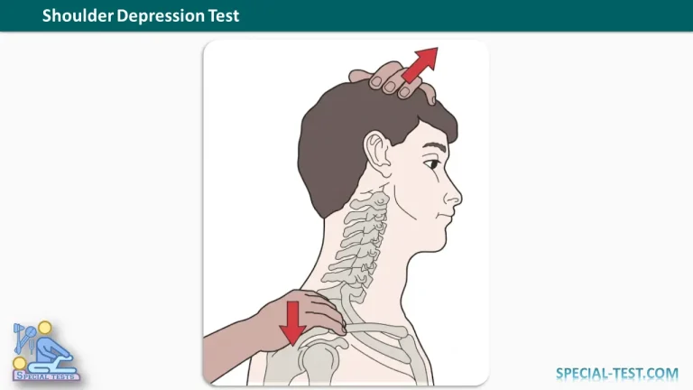 Shoulder Depression Test