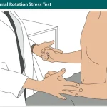 External Rotation Stress Test