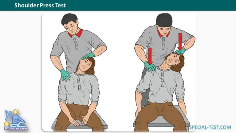 Shoulder Press Test