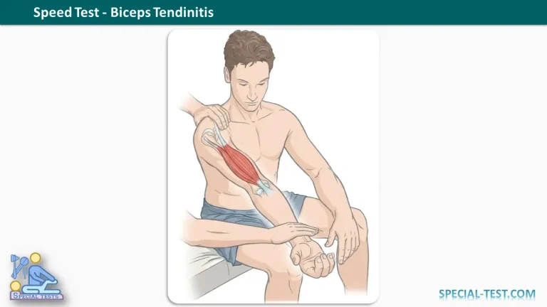 Speed Test Biceps Tendinitis