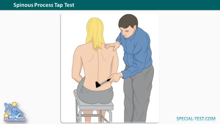 Spinous Process Tap Test