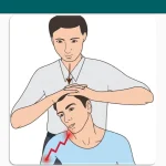 Spurling’s Test