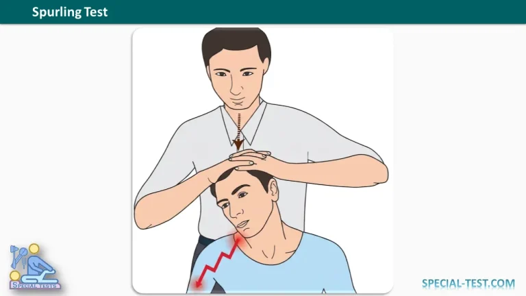 Spurling Test
