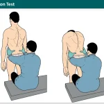 Standing Flexion Test